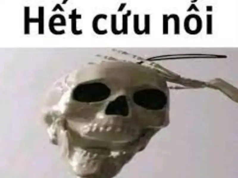 Meme hết cứu 35